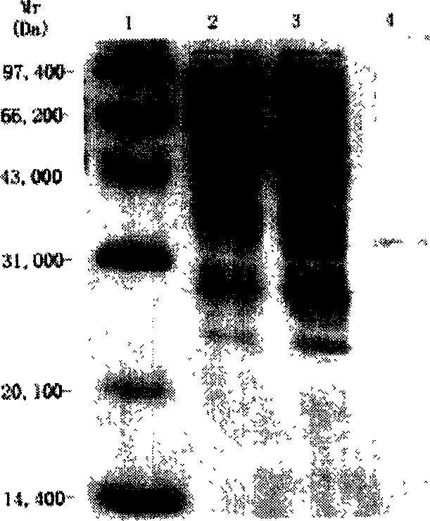 Variable region of light chain and heavy chain genes of anti-KDR monoclonal antibody and its use