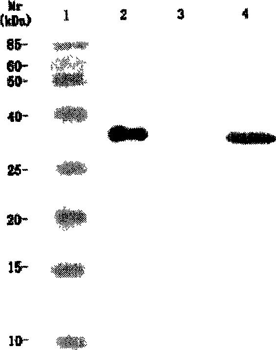 Variable region of light chain and heavy chain genes of anti-KDR monoclonal antibody and its use