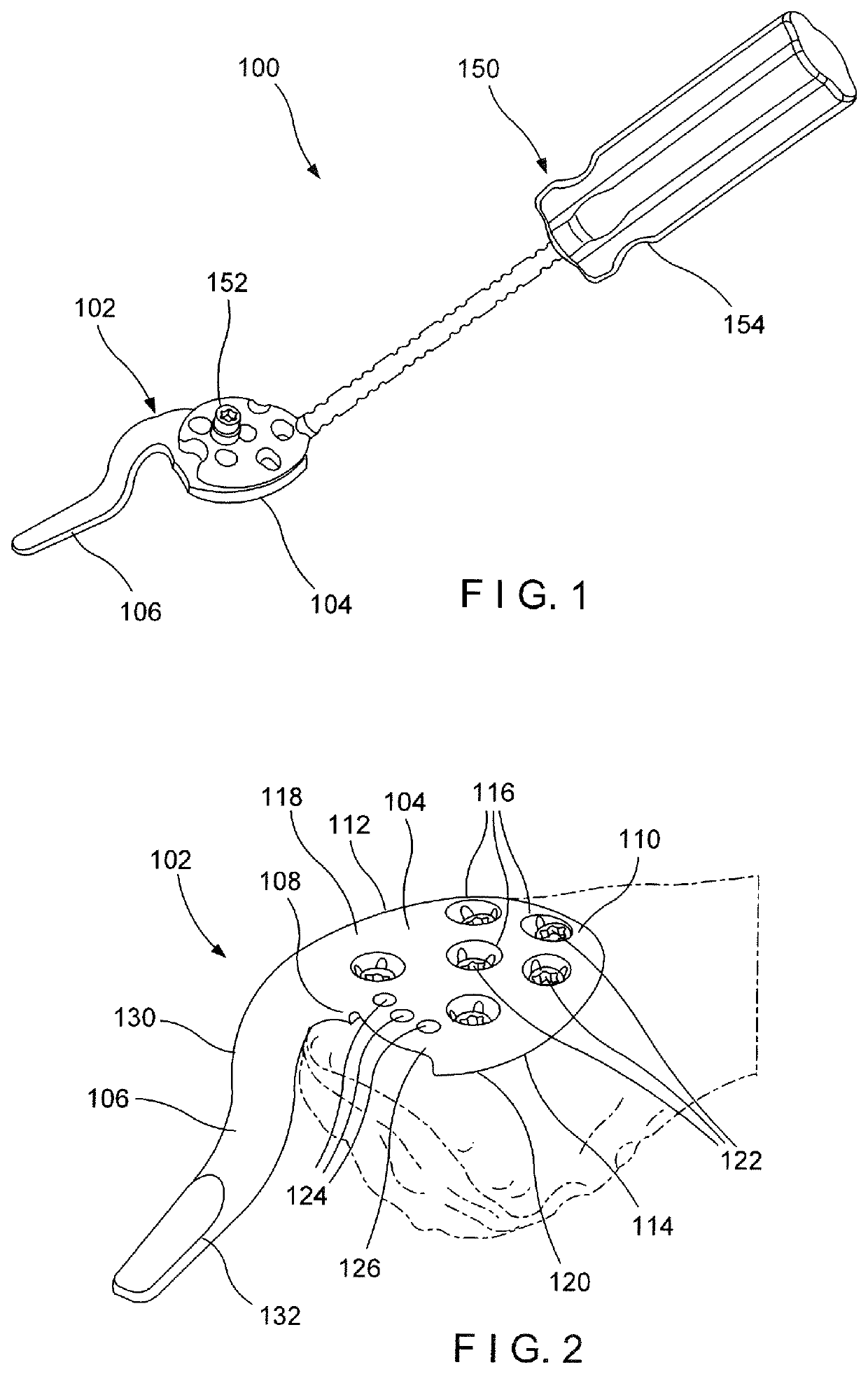 Acromioclavicular hook plate