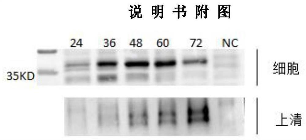 Novel coronavirus, preparation method for specific-antibody-containing milk or serum produced by dairy cow immunized by novel coronavirus and application of specific-antibody-containing milk or serum