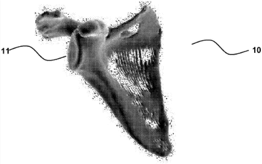 Shoulder replacement apparatus