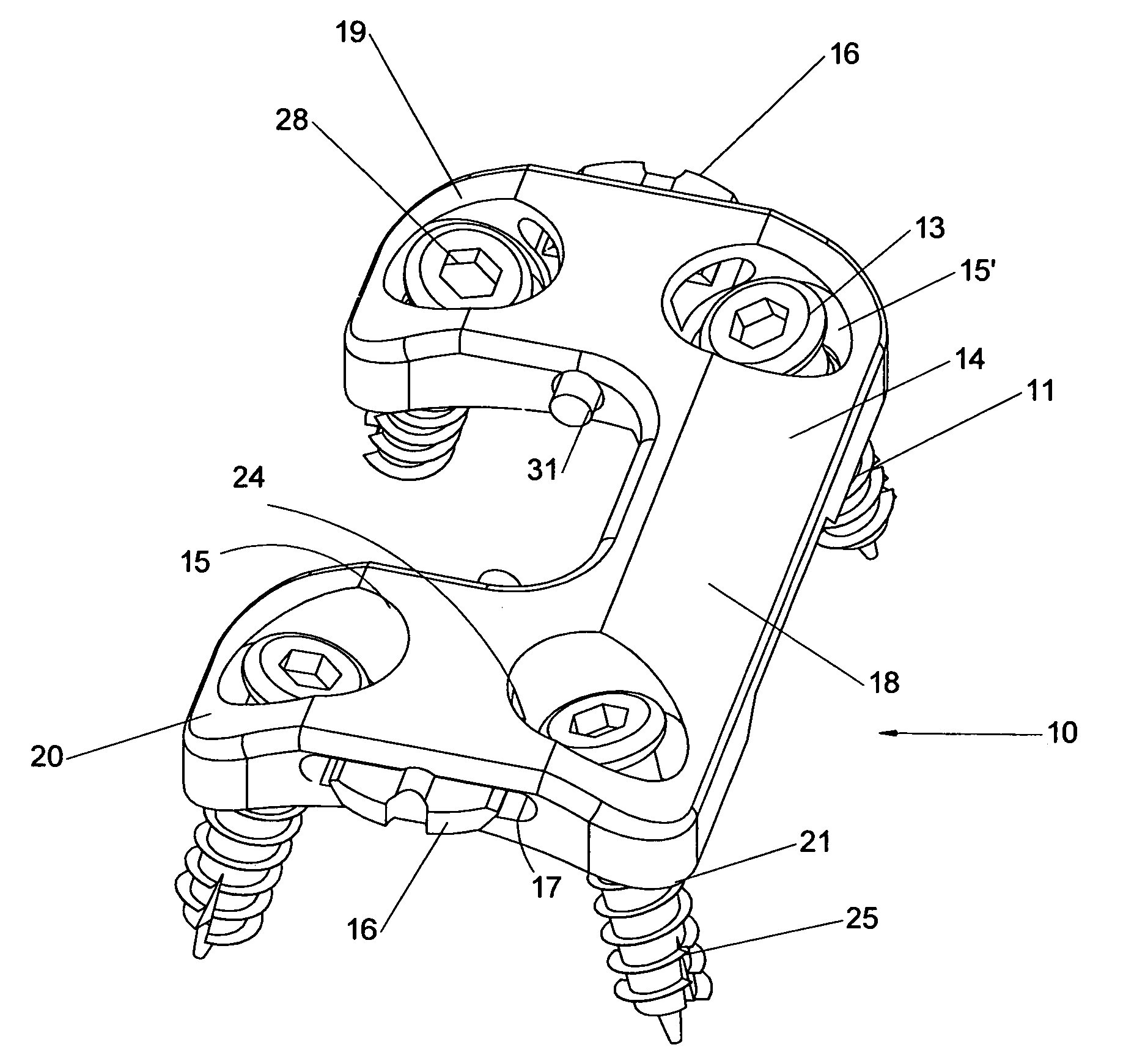 Static anterior cervical plate