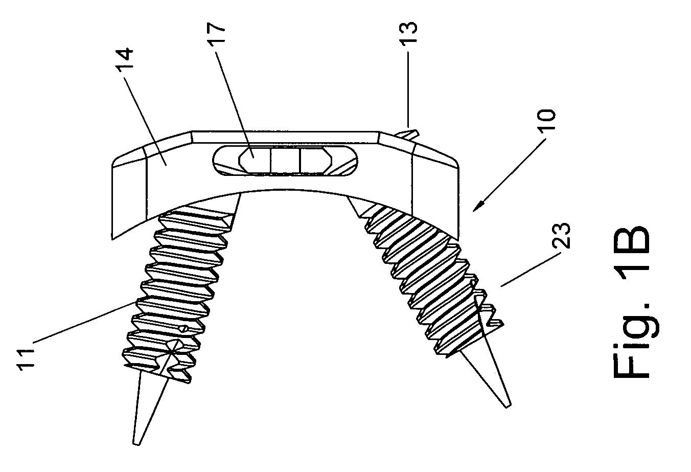 Static anterior cervical plate