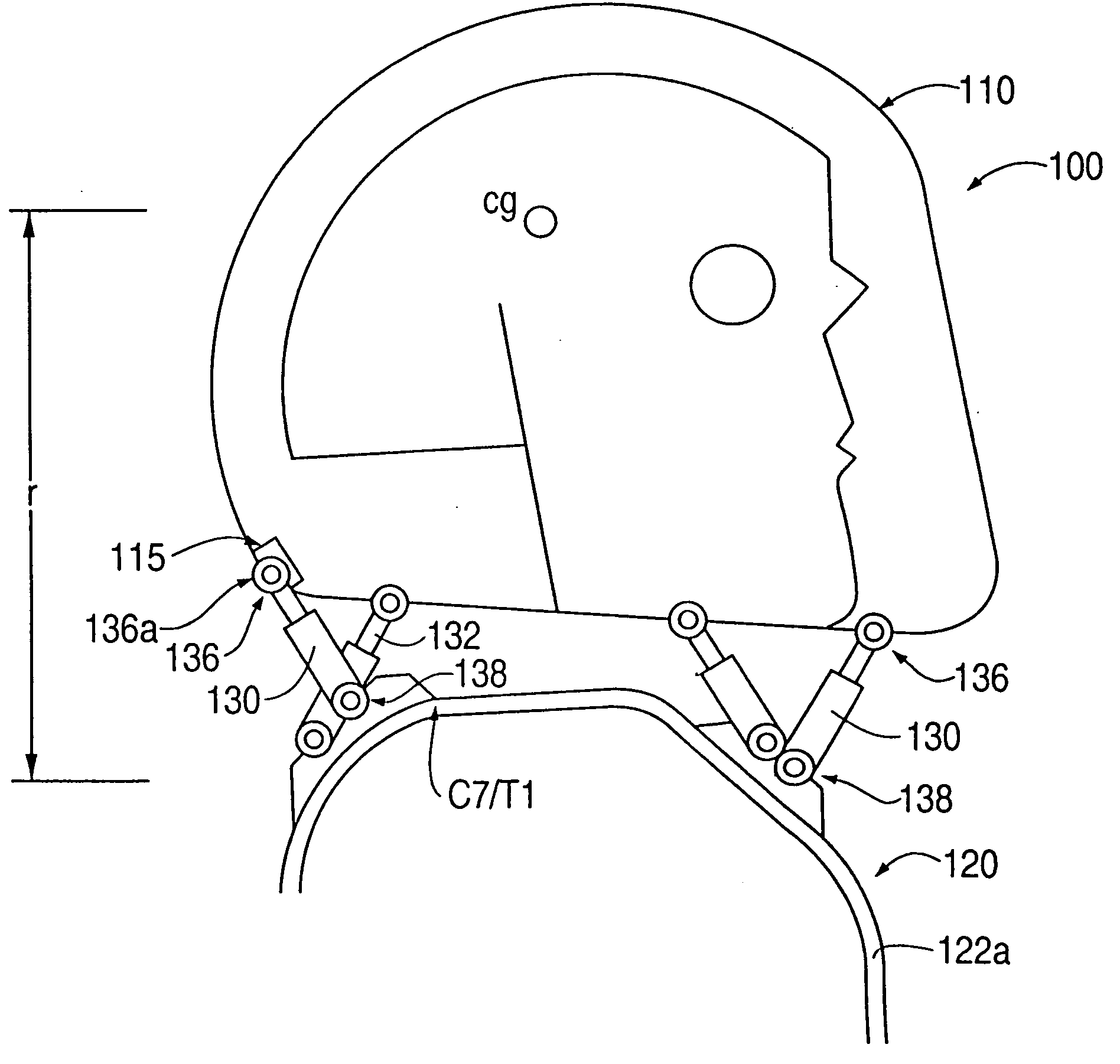 Head stabilizing system