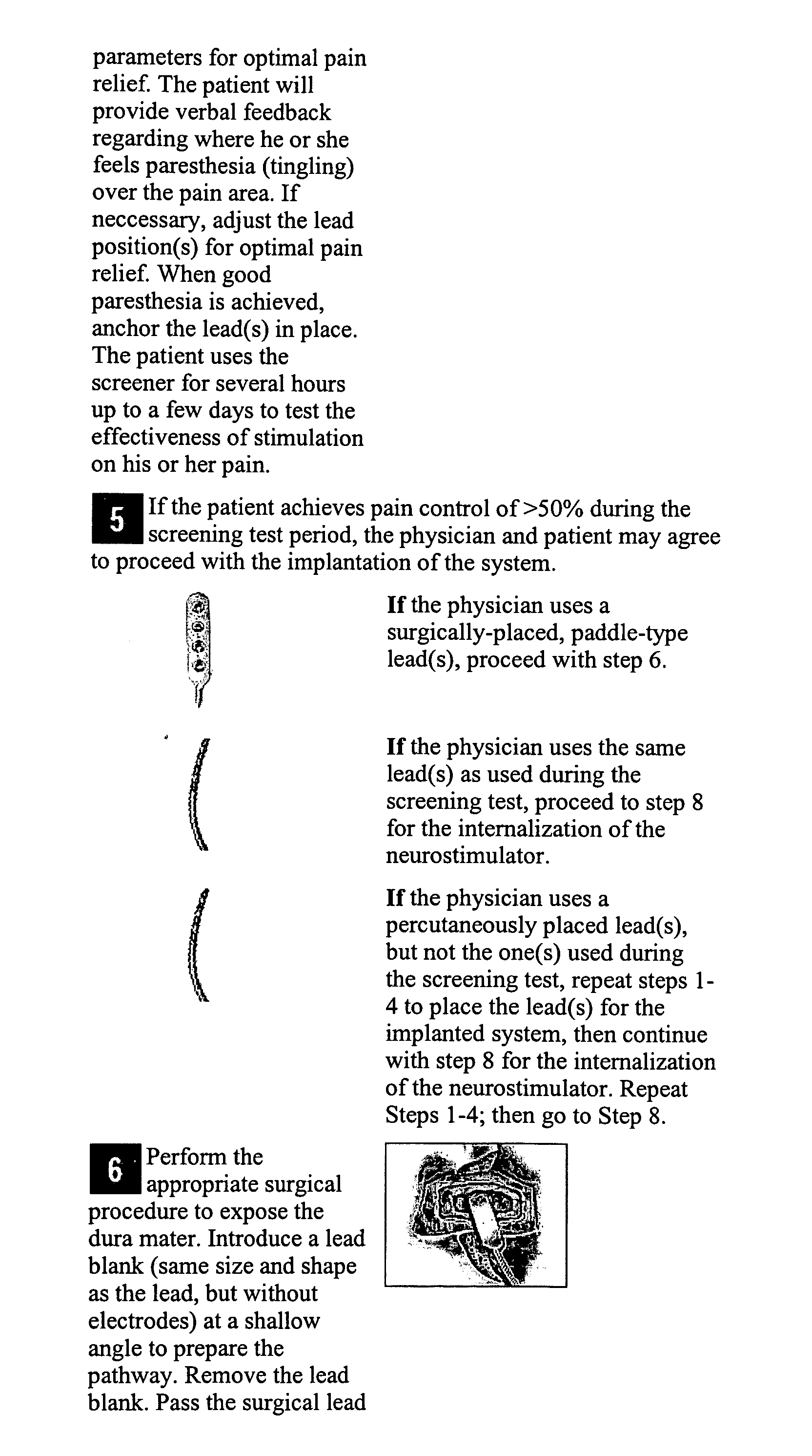 Tunneling needle design having an on-demand removable hub