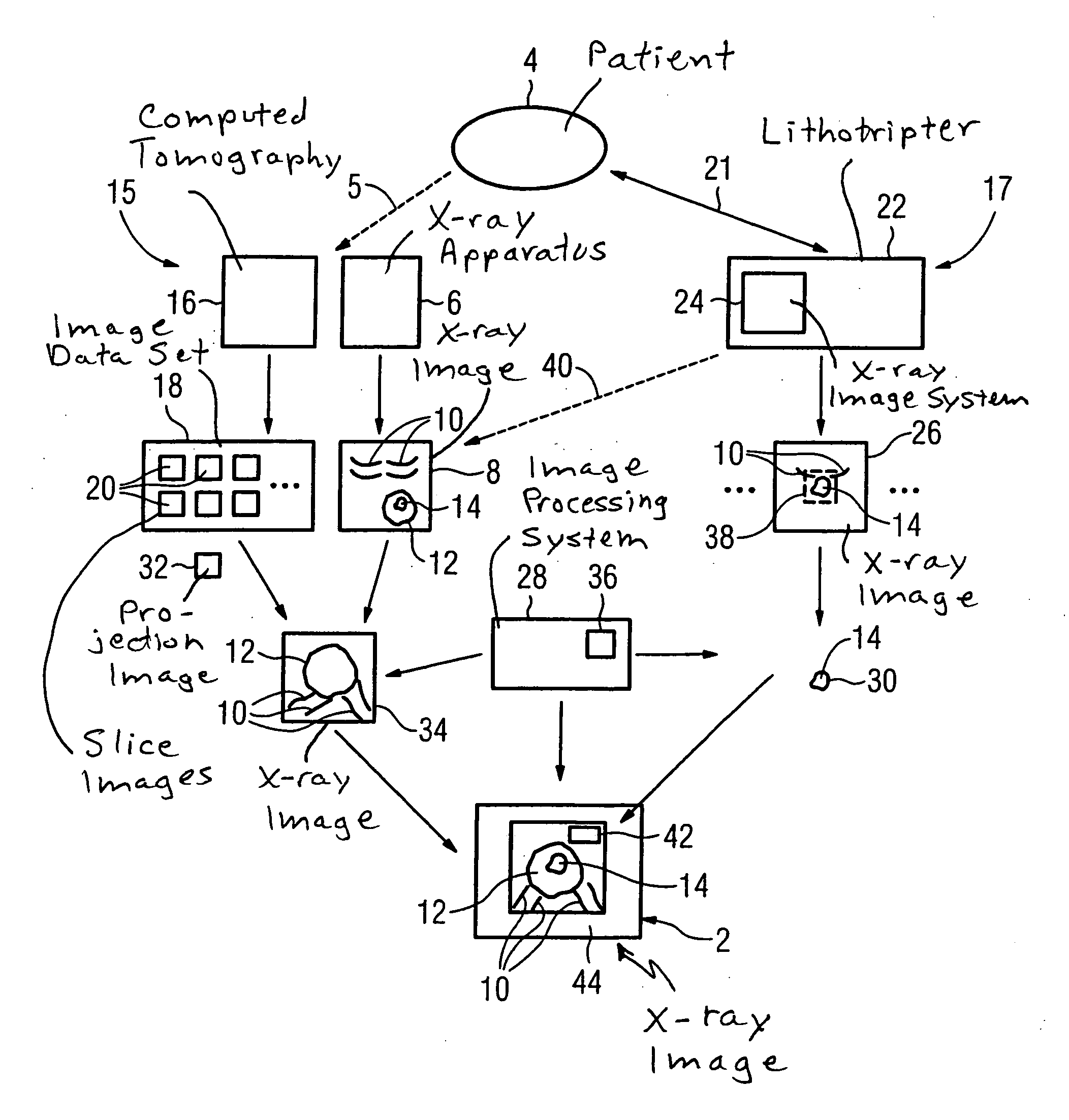 Method and apparatus for x-ray imaging of a patient during a shockwave treatment