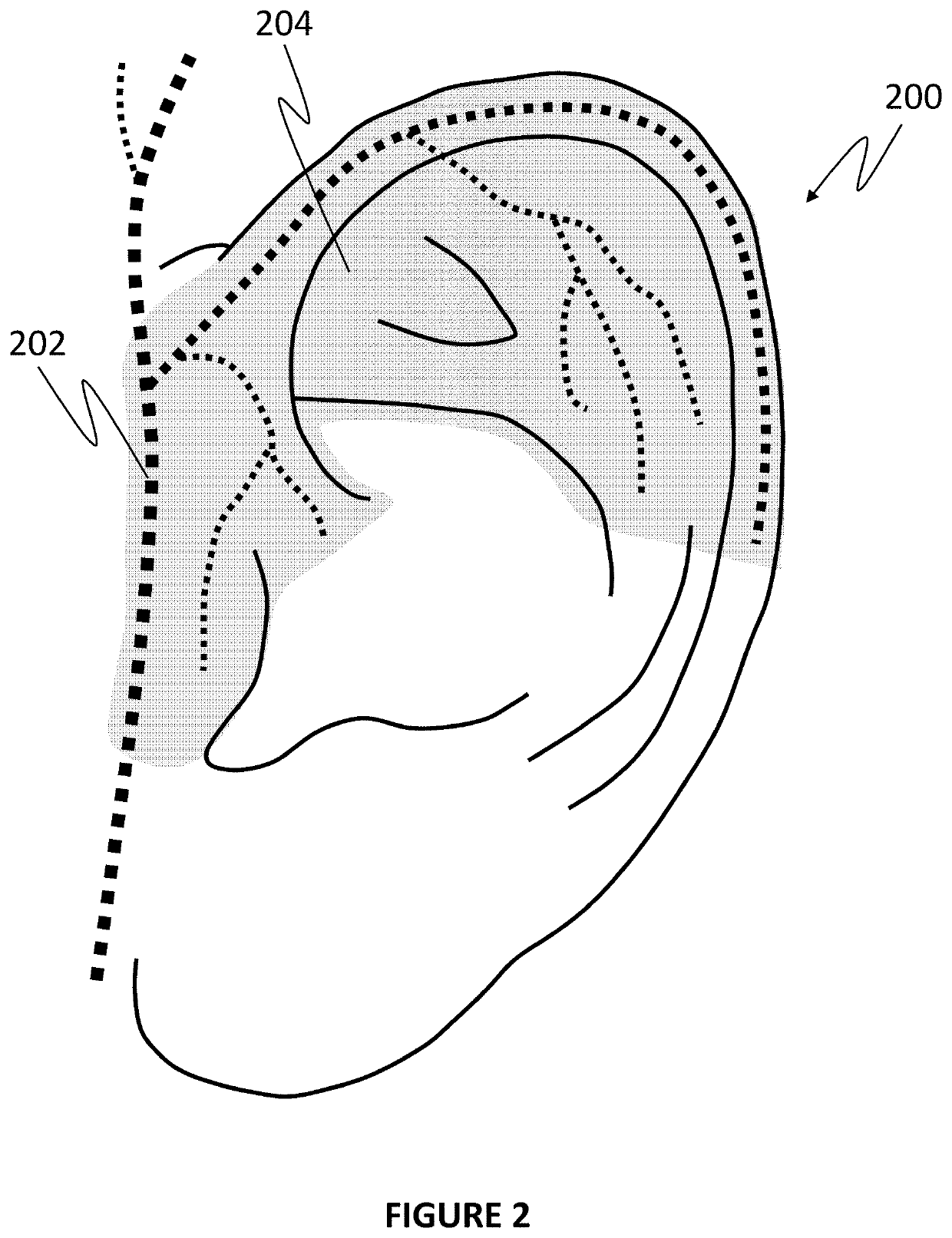 Non-invasive and selective bioelectronic control of blood pressure