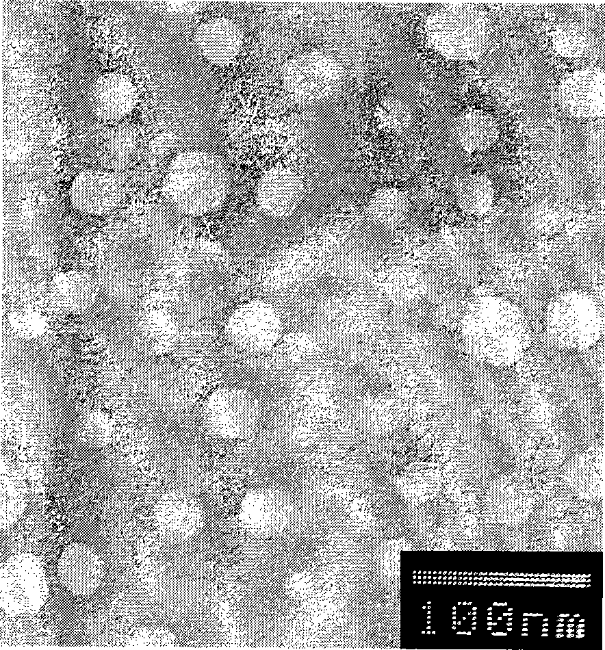 Lipase gel particle and preparation thereof