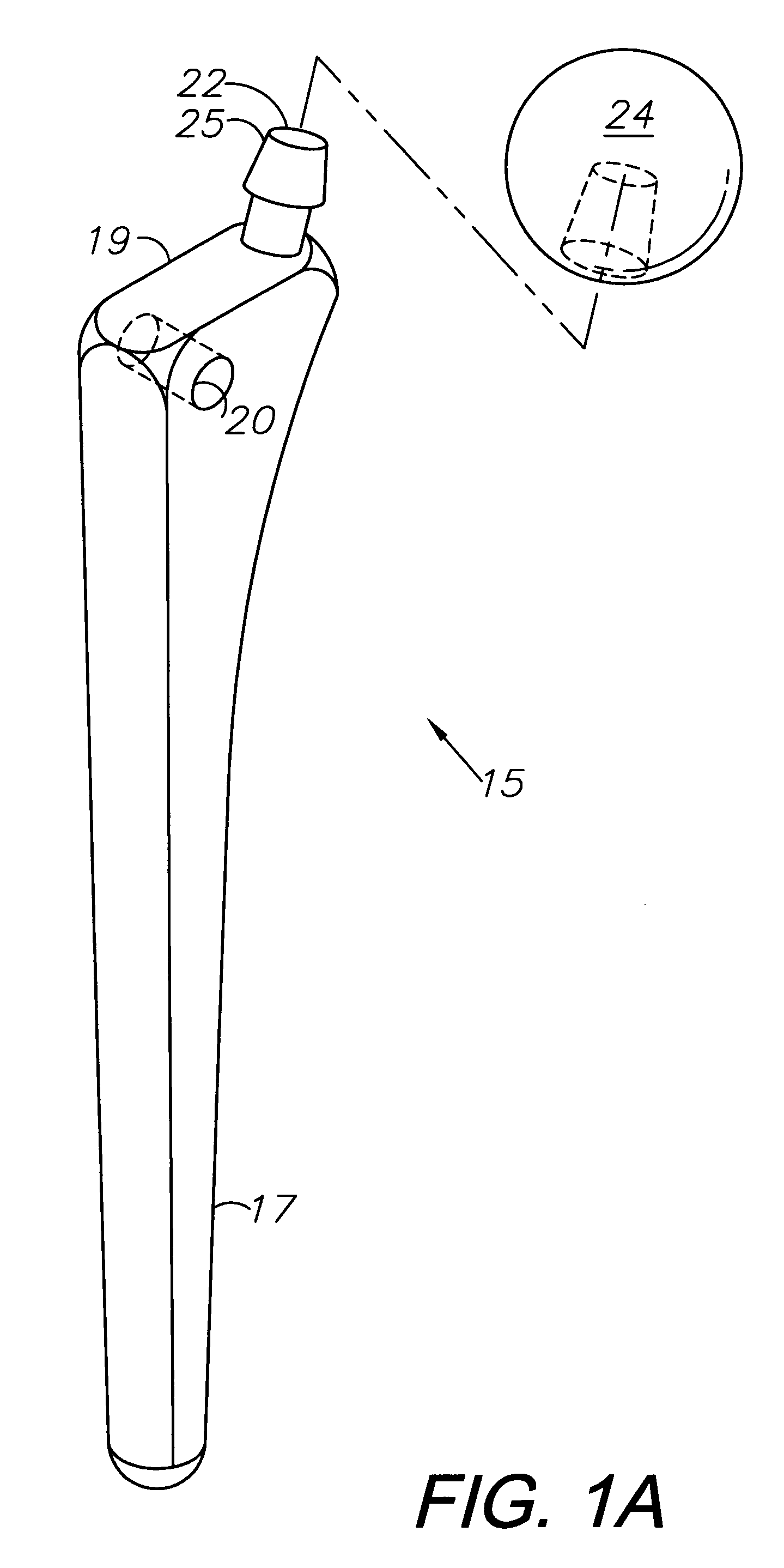 Orthopedic and dental implant system and method