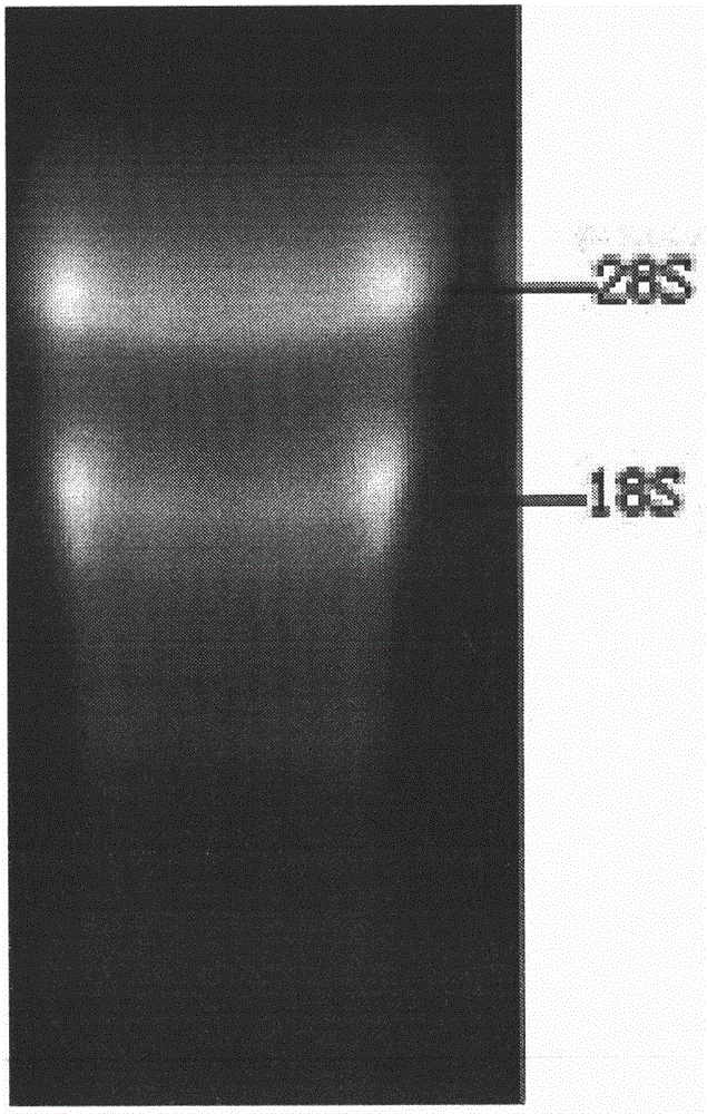 Method for extracting total RNA from leucaena leucocephala leaf tissue