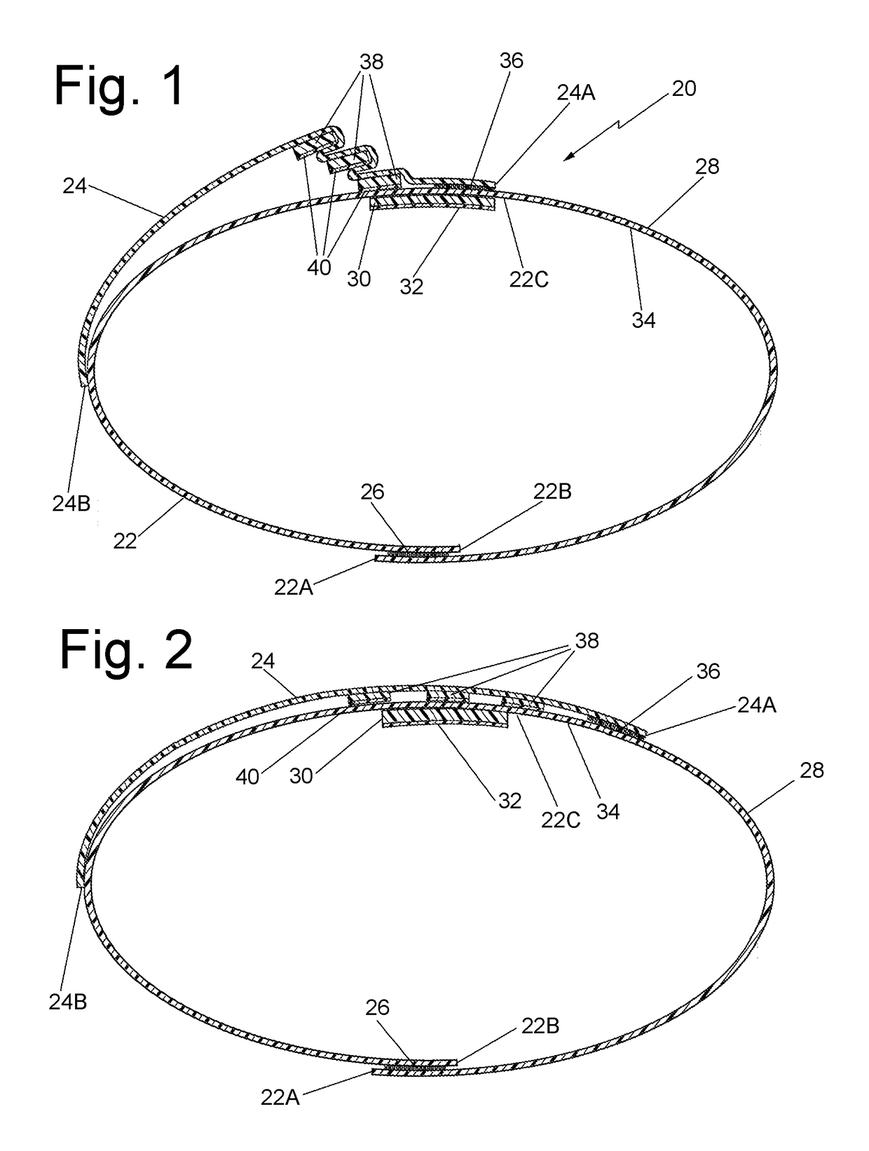 Bandage for reducing blood leakage from aggressive bleeding site