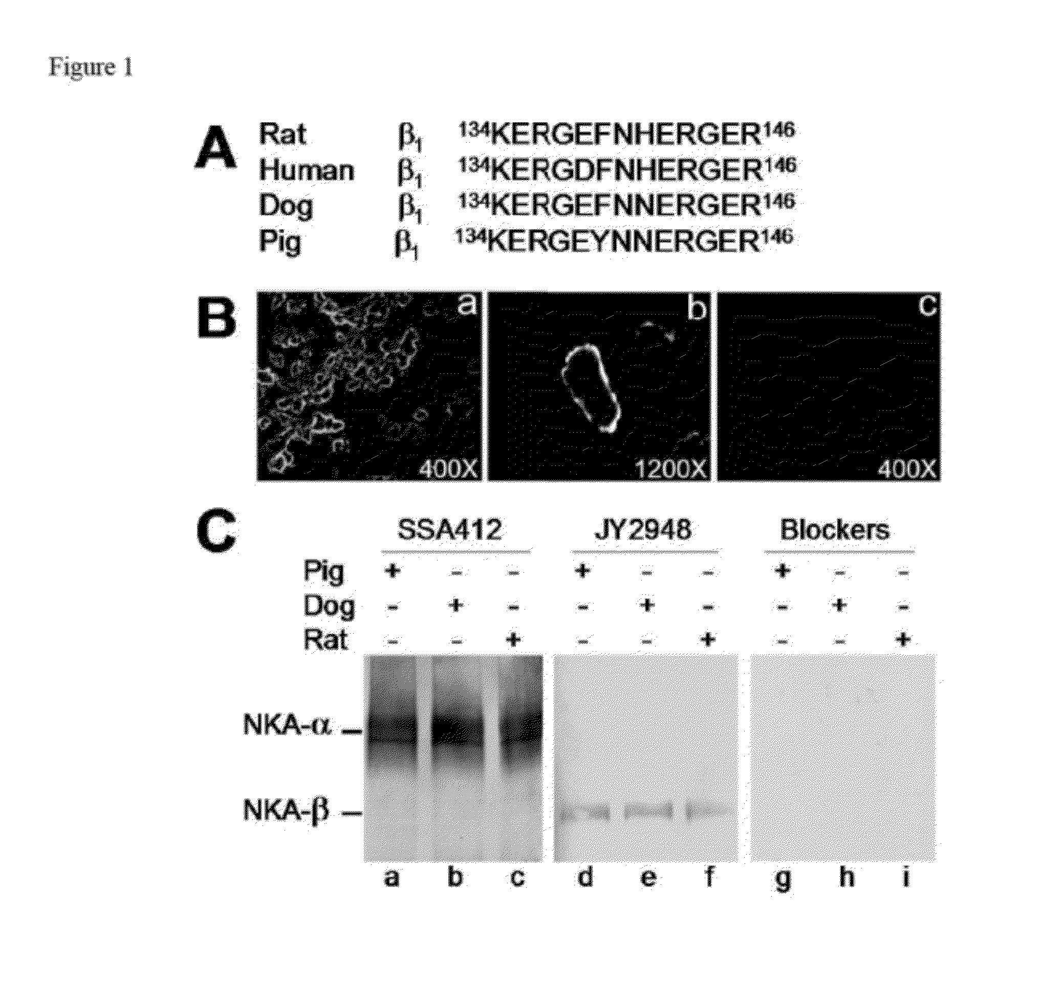 Sodium pump antibody agonists and methods of treating heart disease using the same