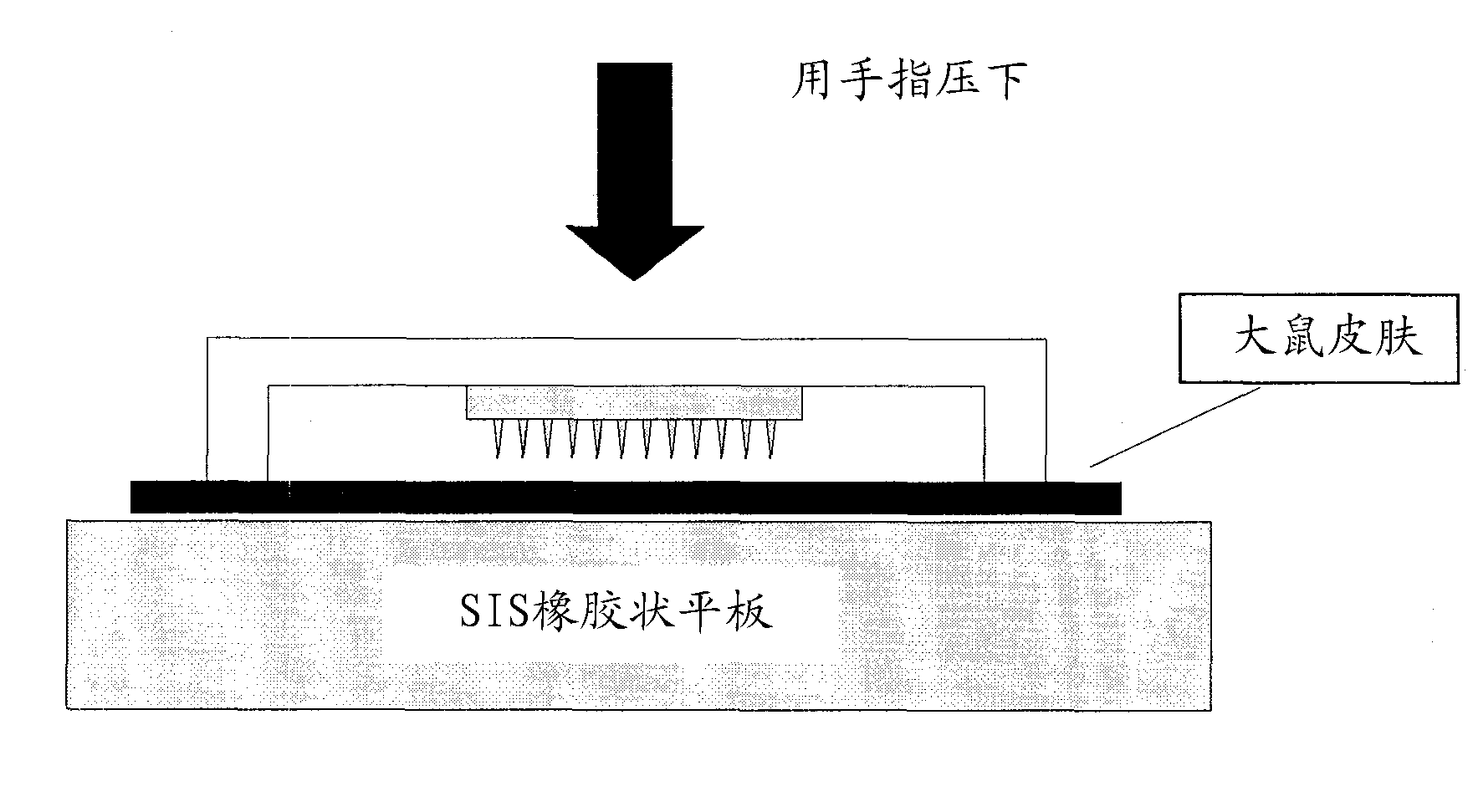 Applicator device of pinholder type microneedle