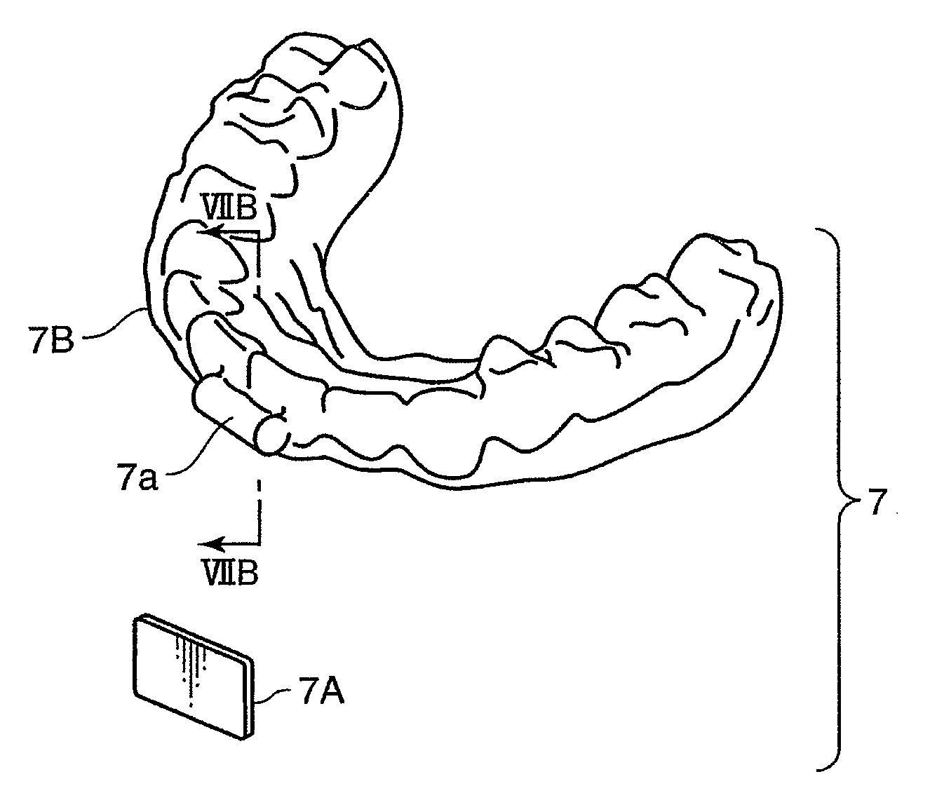 Orthodontic appliance