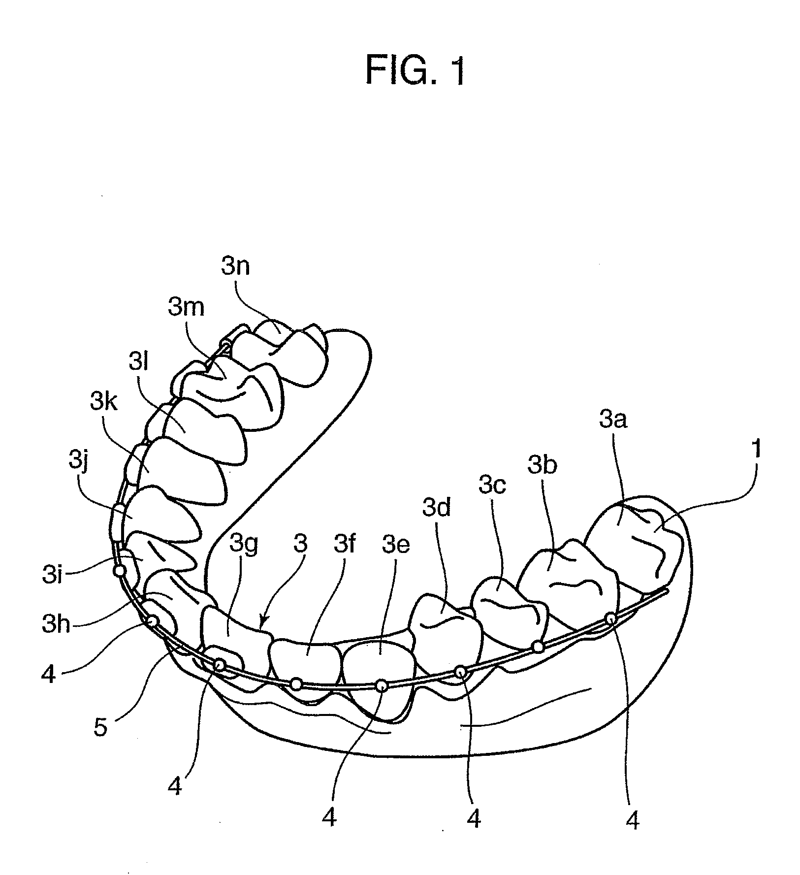 Orthodontic appliance