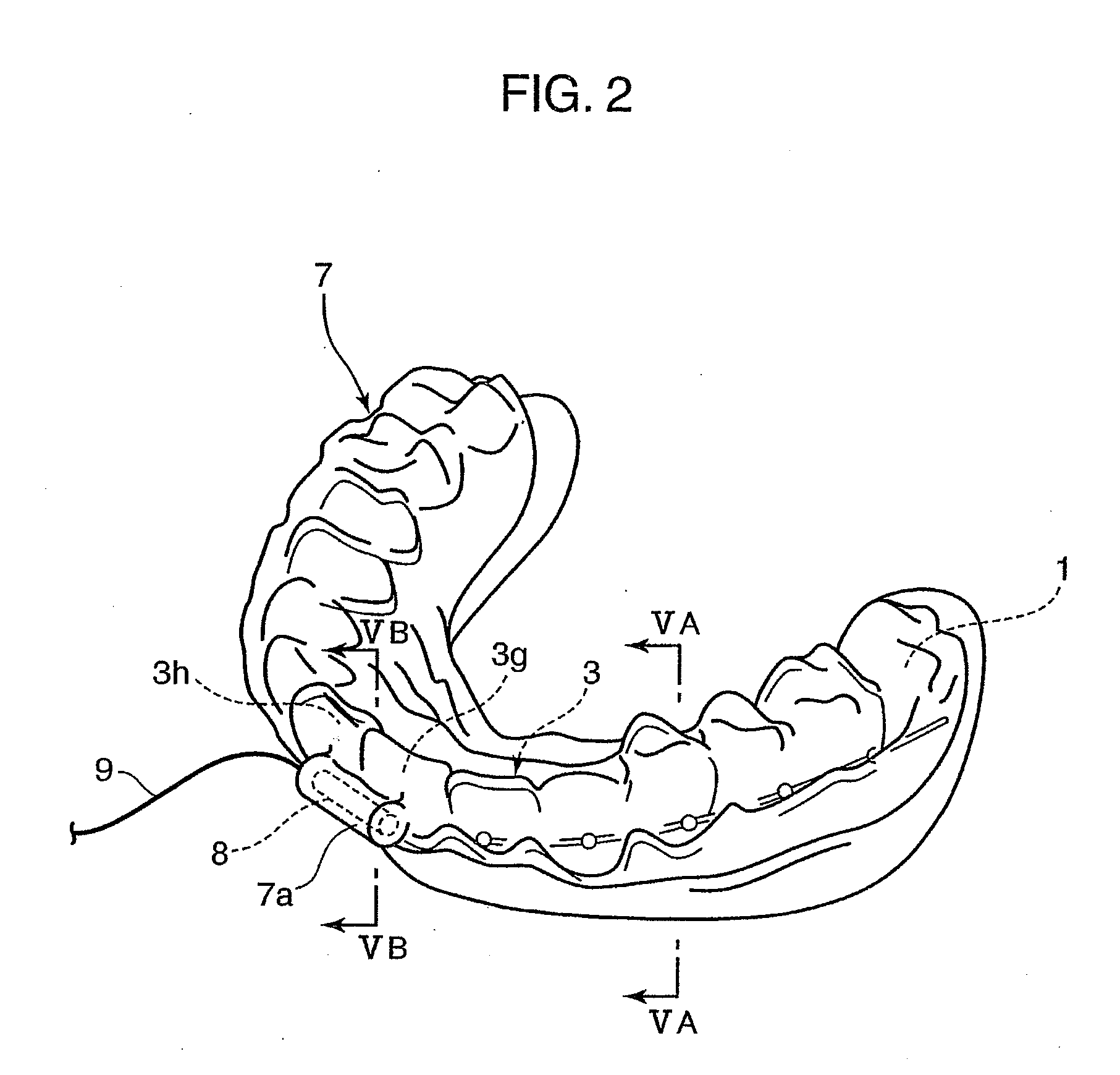 Orthodontic appliance