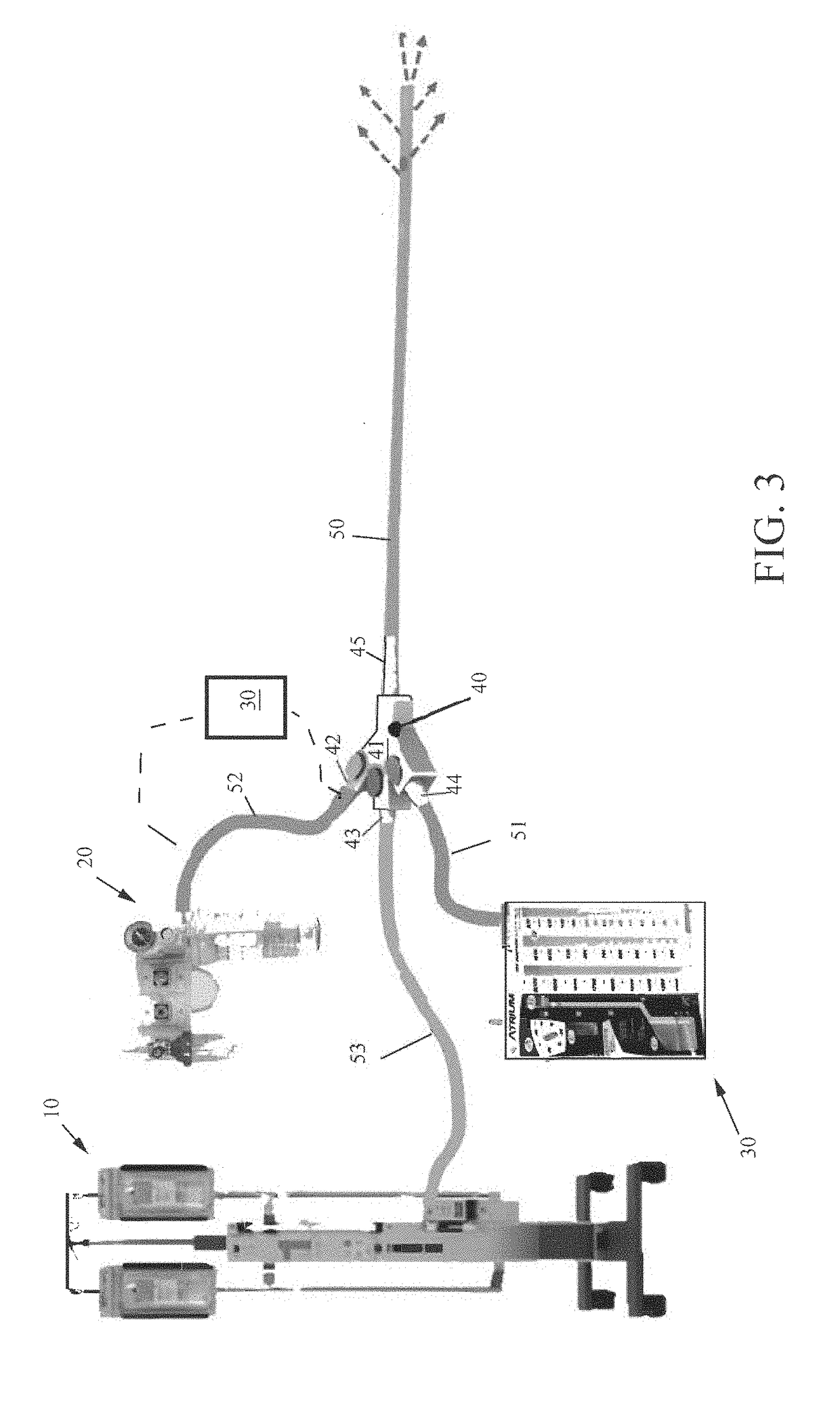 System for improving fluid drainage