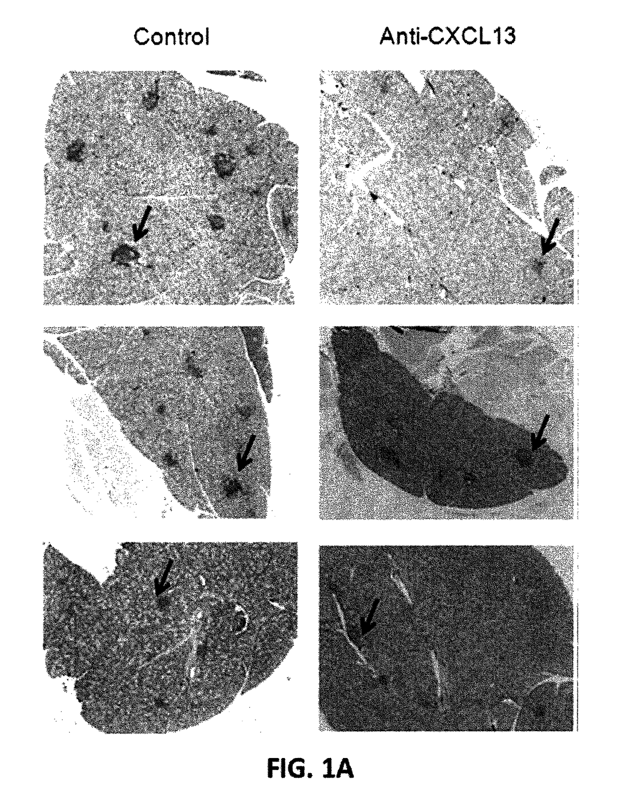 Methods for the treatment of B cell-mediated inflammatory diseases