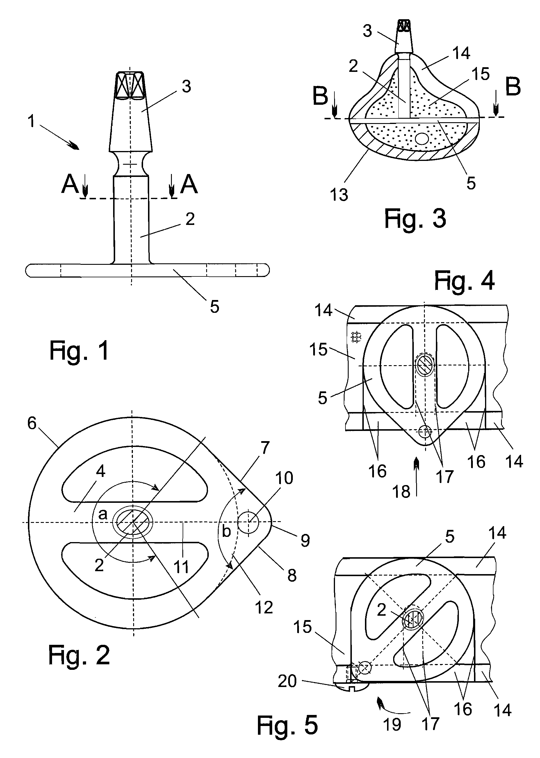 Disk implant