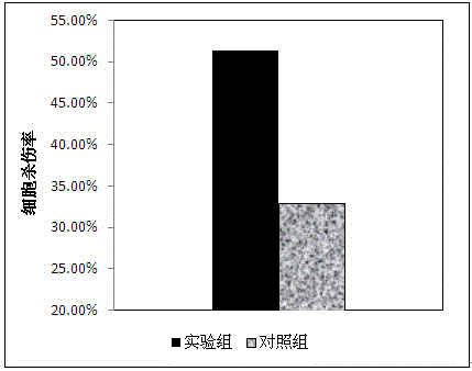 CAR-T cell preparation for treating breast cancer and preparation method thereof