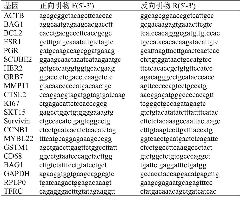 Special chip for detecting breast cancer related gene expression