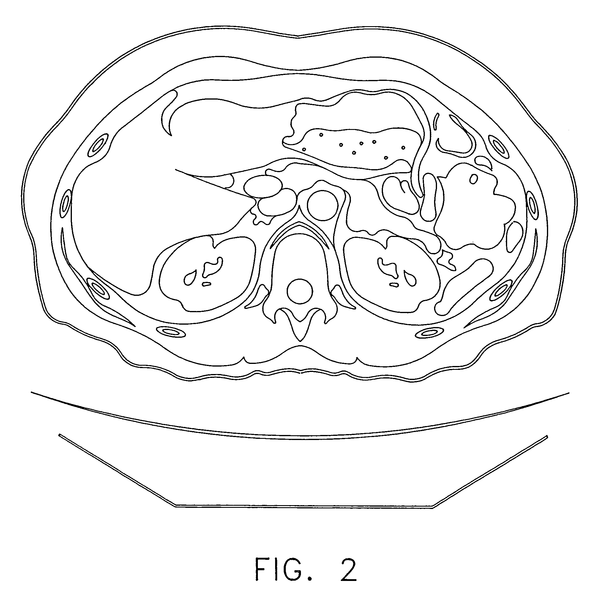 Anatomical visualization and measurement system