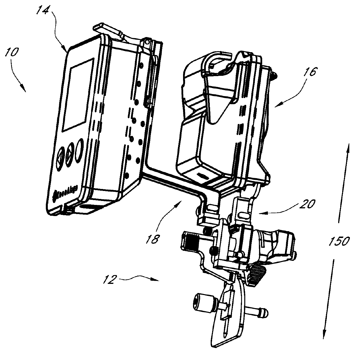 Systems and methods for joint replacement