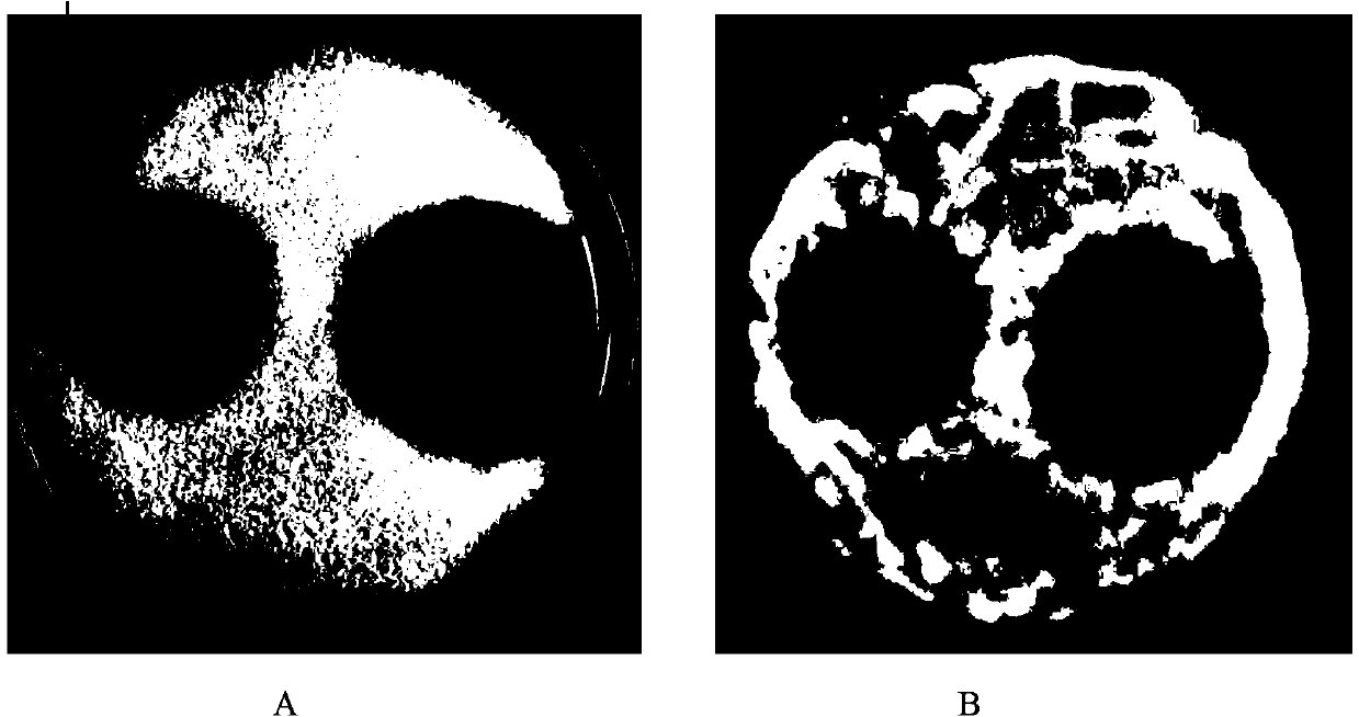 Recombinant streptomyces lydicus with cellulase activity and construction method and application thereof