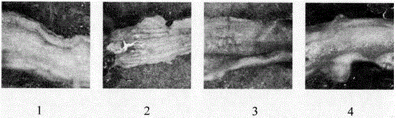 Medicinal composition for treating atherosclerosis and application