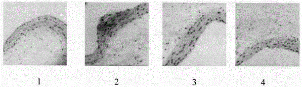 Medicinal composition for treating atherosclerosis and application