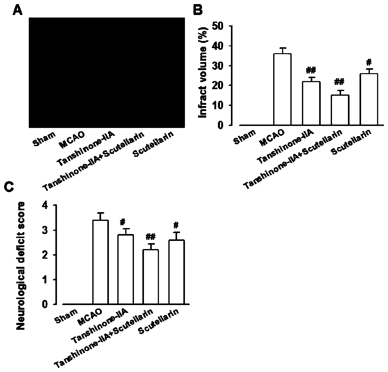 A compound preparation of traditional Chinese medicine monomers for treating cerebral ischemia and its preparation method