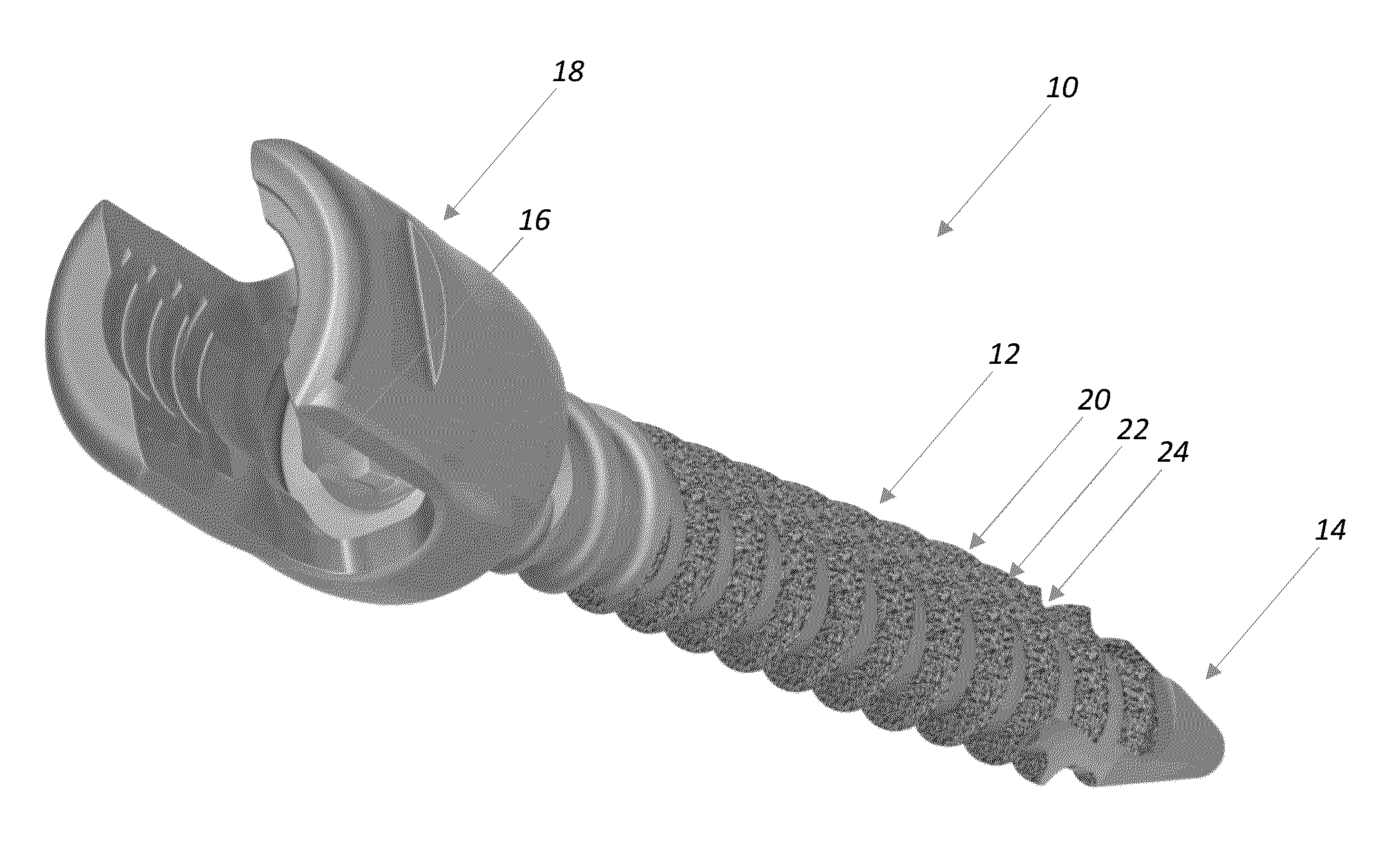 Bone screw incorporating a porous surface formed by an additive manufacturing process