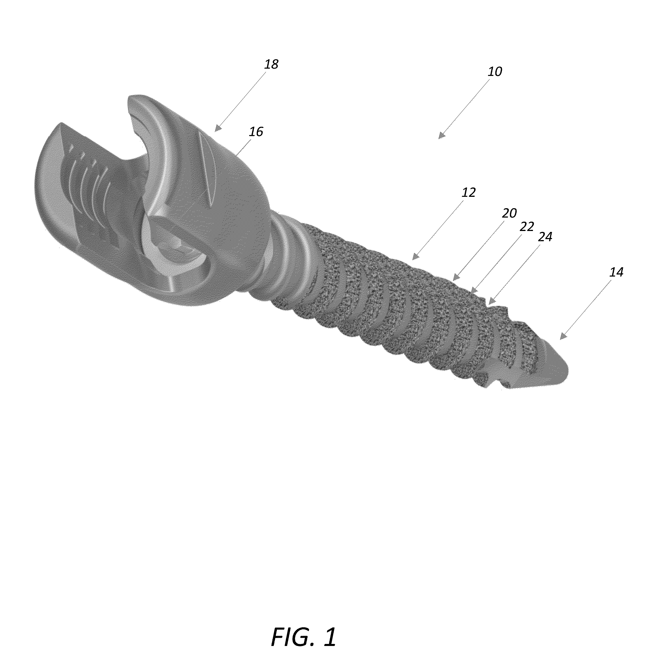 Bone screw incorporating a porous surface formed by an additive manufacturing process