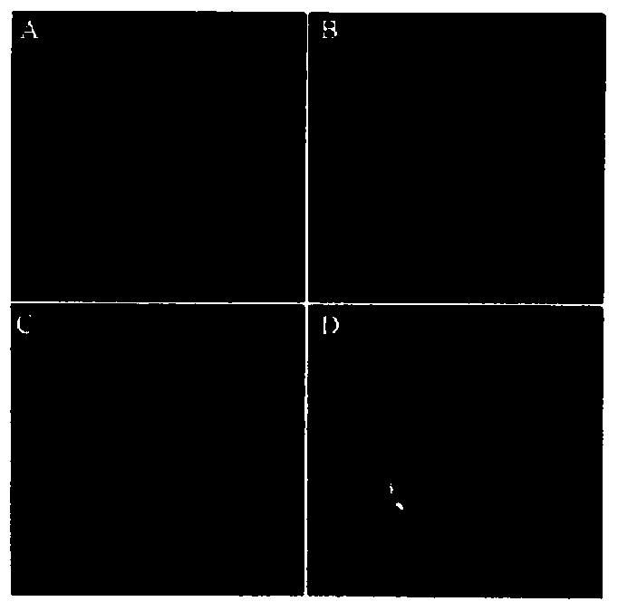 Positron nuclide-labeled dansylamide stilbene compound, its synthesis method and application