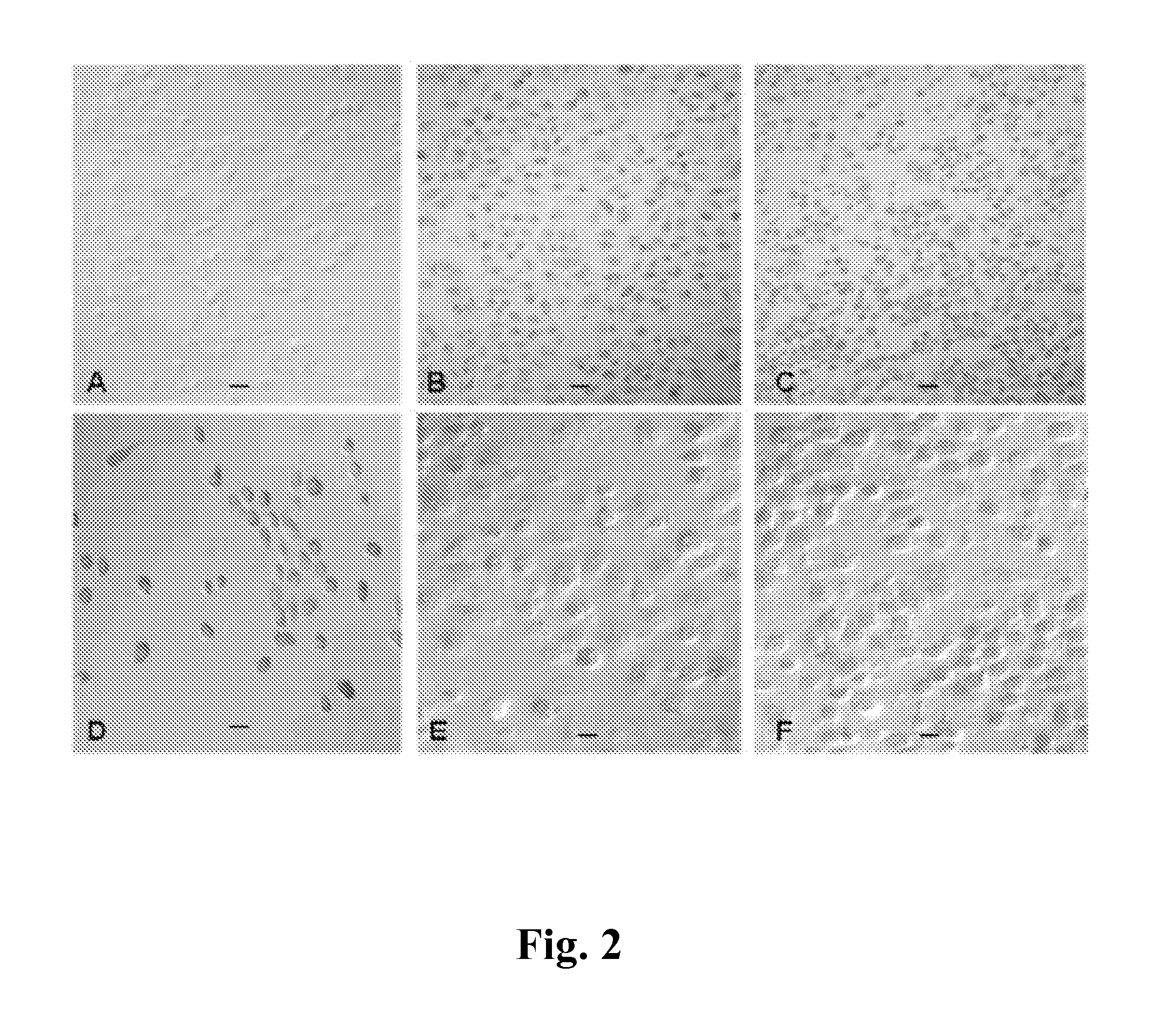 Method for peptide histochemical diagnosis