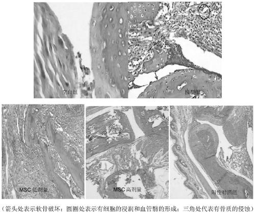 Anti-rheumatoid arthritis human umbilical cord mesenchymal stem cell injection and preparation method thereof