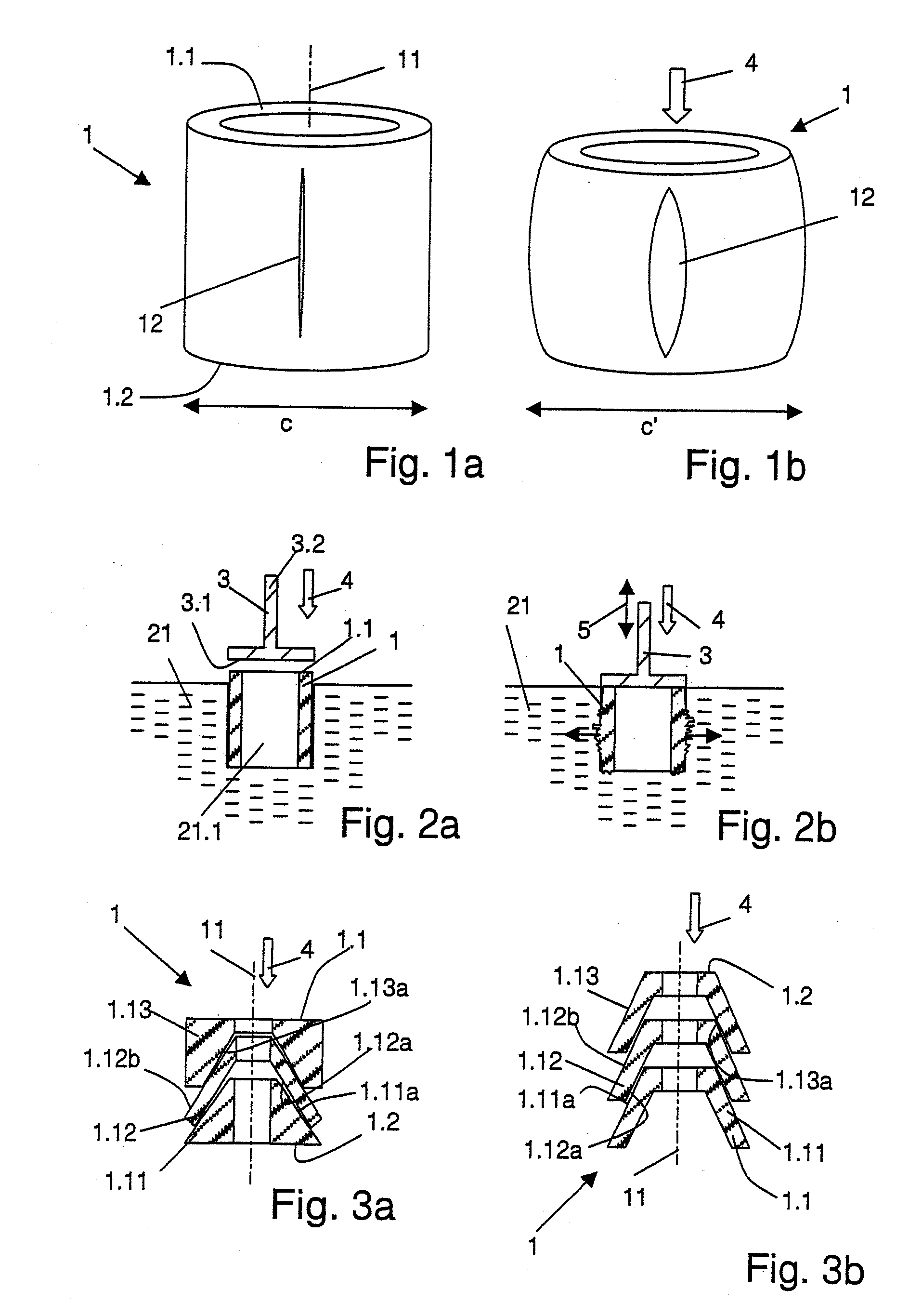 Anchoring in a construction model