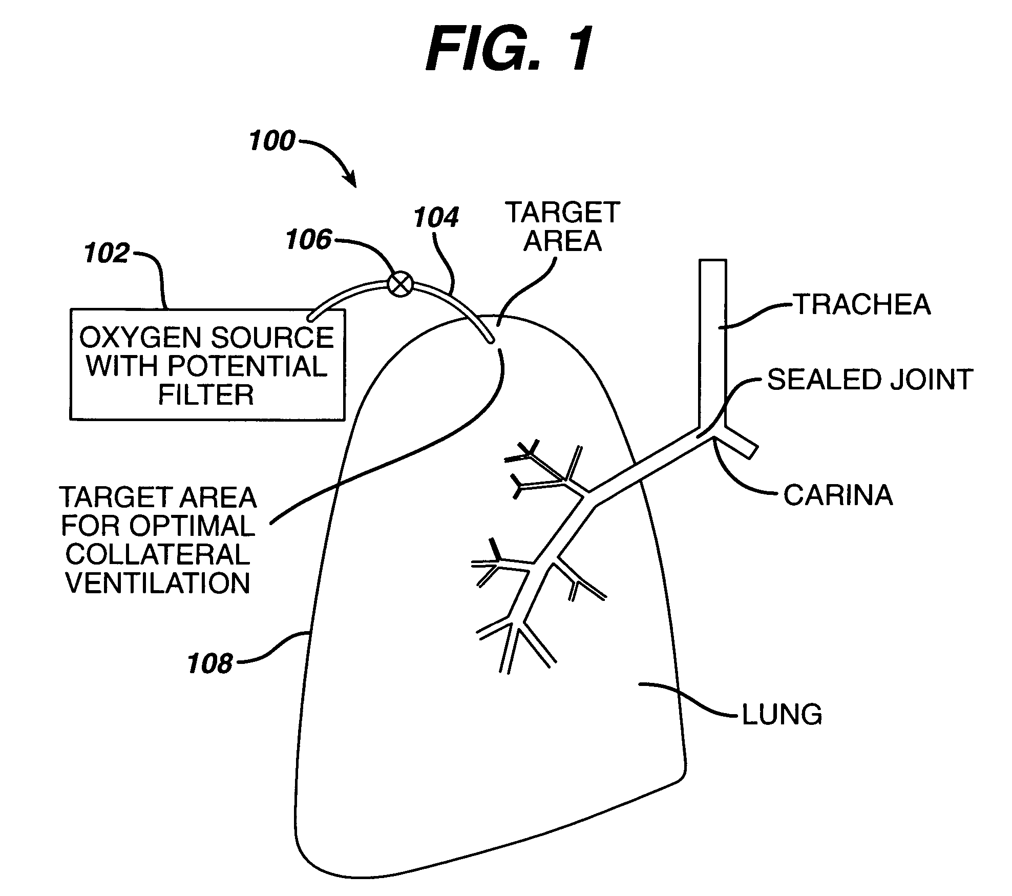 Methods to accelerate wound healing in thoracic anastomosis applications