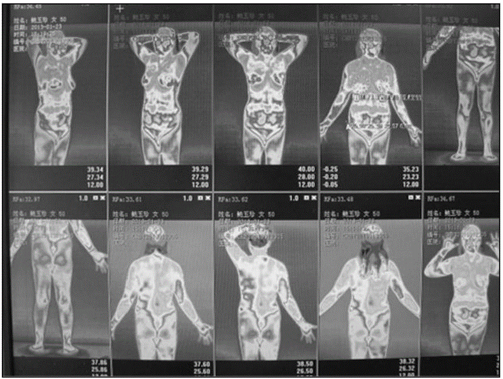 Human body terahertz wave simulation rehabilitation physiotherapy apparatus for conditioning sub-health and physiotherapy method of physiotherapy apparatus