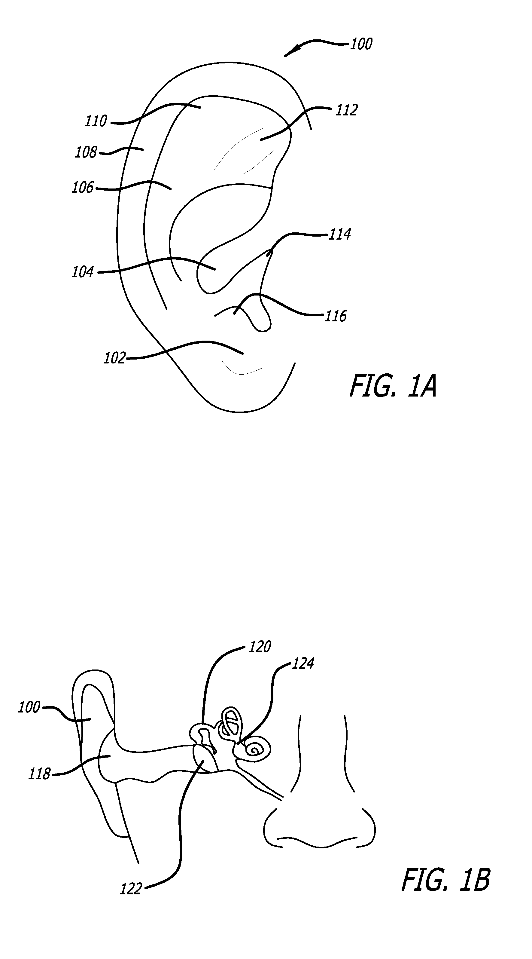 Silent Effusion Removal