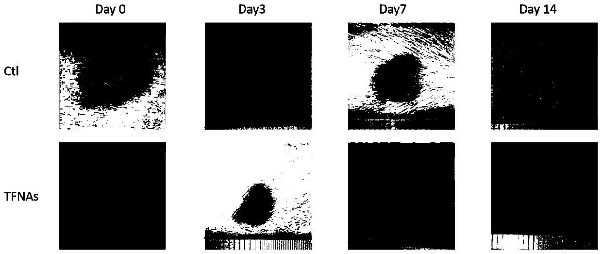 Application of tetrahedral skeleton nucleic acid in preparing medicine for skin repairing