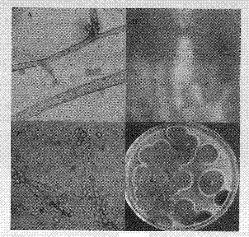 Method for increasing fermentation yield of epothilone by using competitive microorganism and application thereof