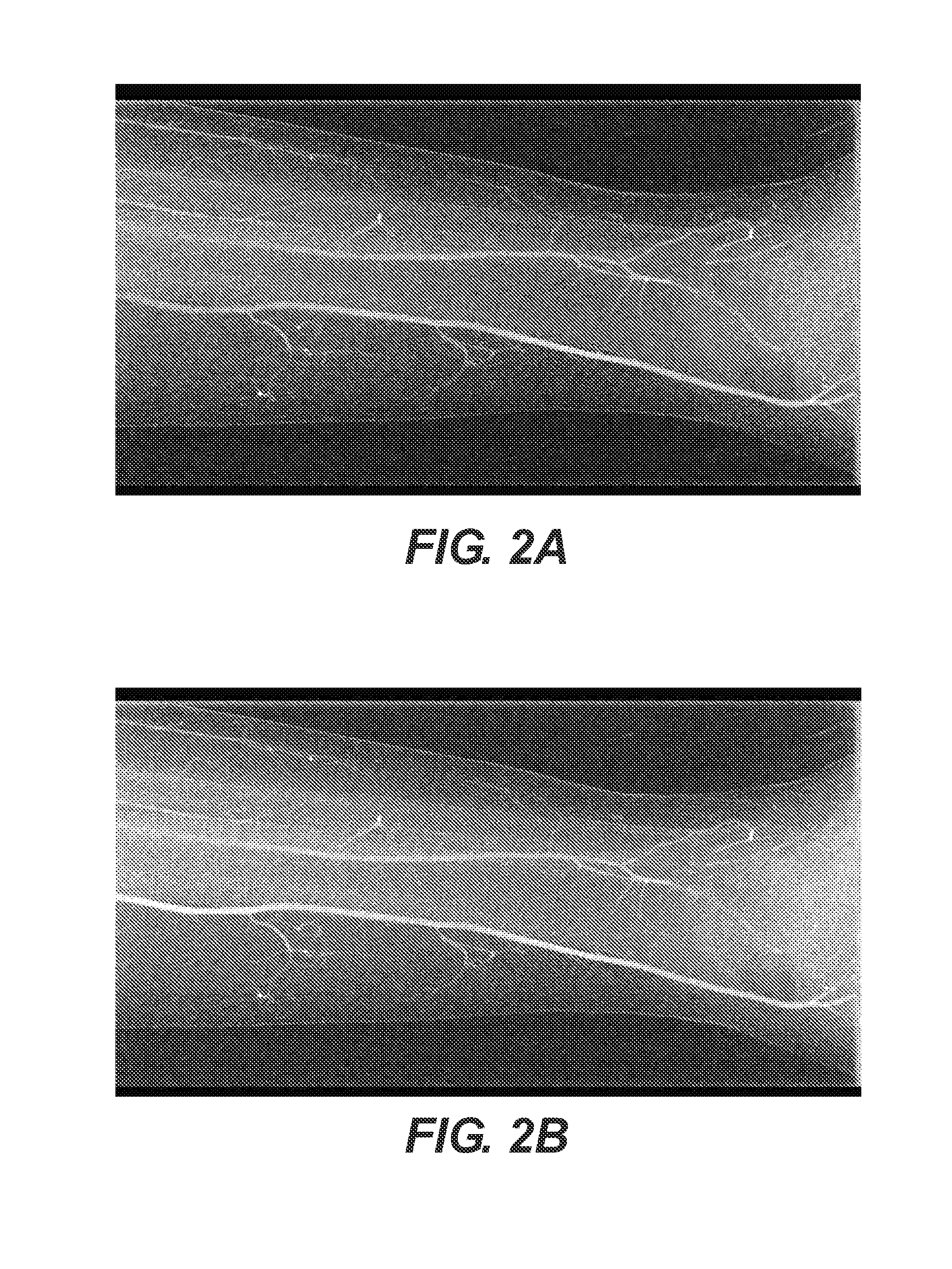 Method for efficient digital subtraction angiography