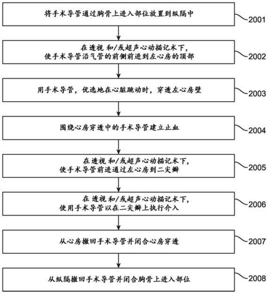 Devices and methods for catheter-based cardiac procedures