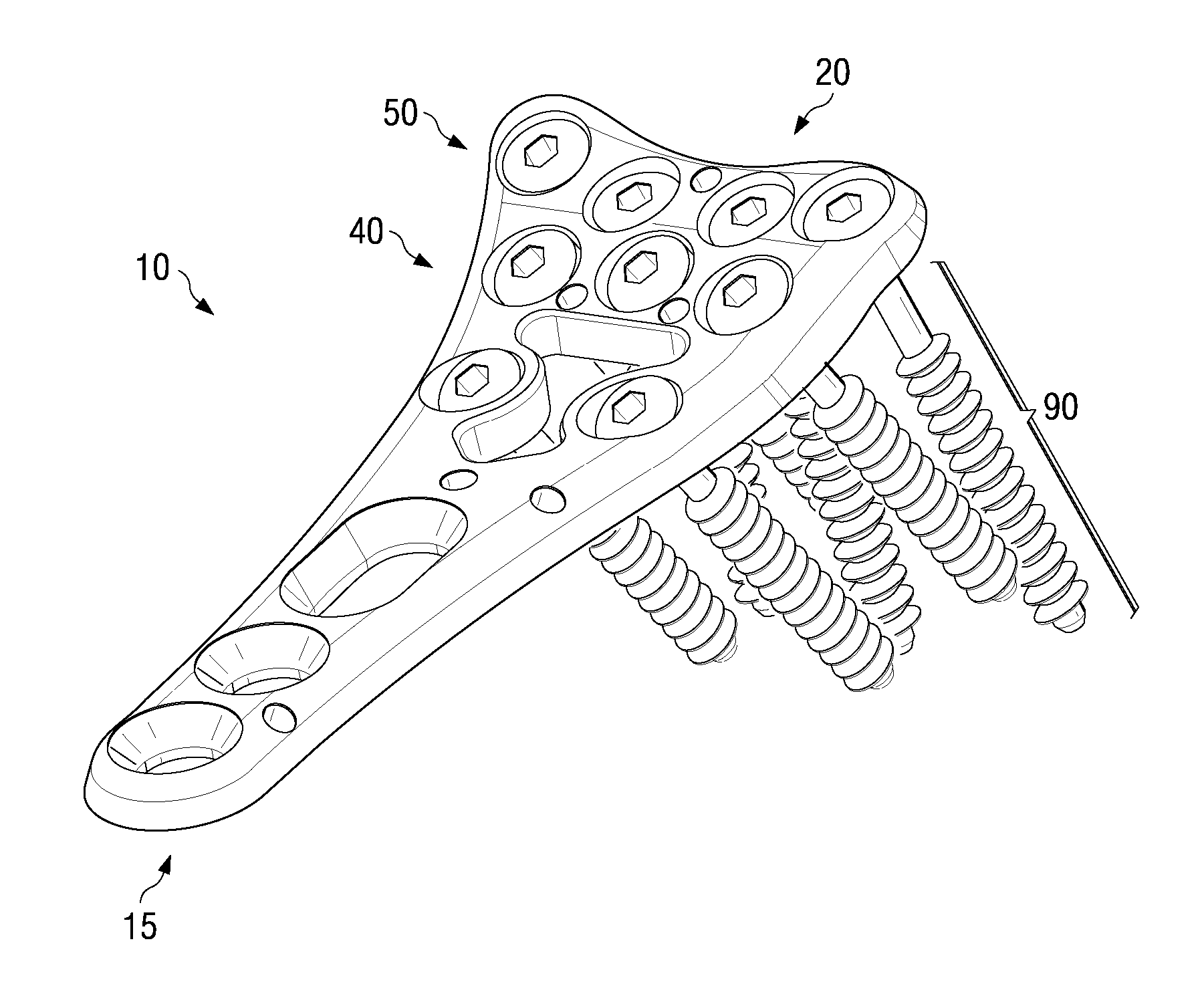 Volar plate fixation device