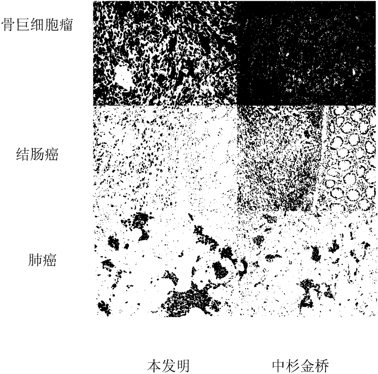 Hybridoma cell strain, CD68 monoclonal antibody, preparation method and application