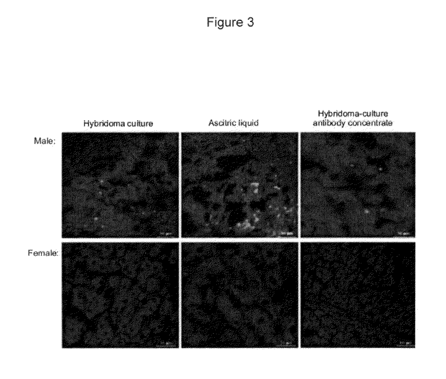 Method of enriching spermatozoa of mammals bearing x-chromosome or y-chromosome