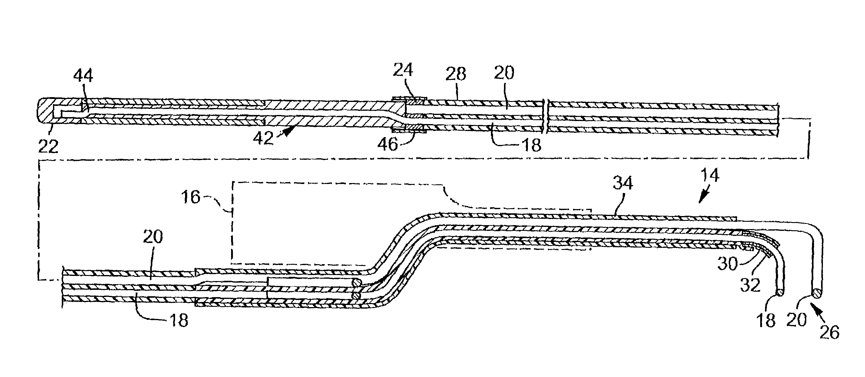 Bipolar resectoscope electrode