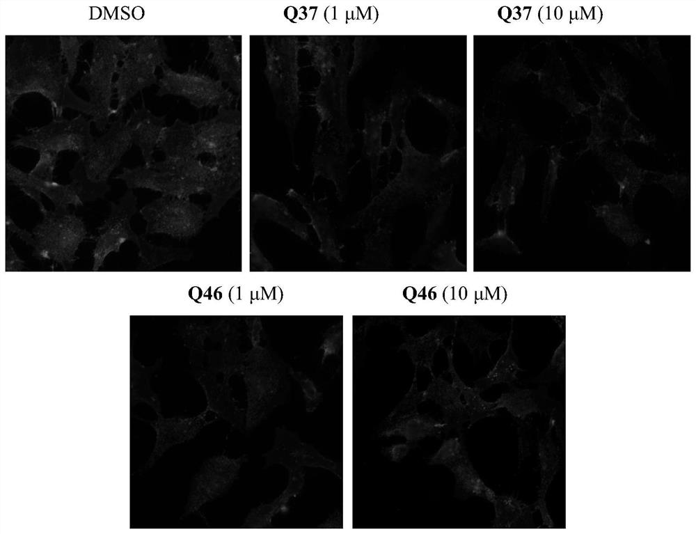 Cholic acid derivative and application thereof in lowering cholesterol