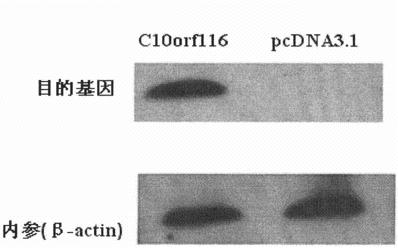 Application of C10orf116 genes in preparing medicament for improving insulin sensitivity of adipose tissue